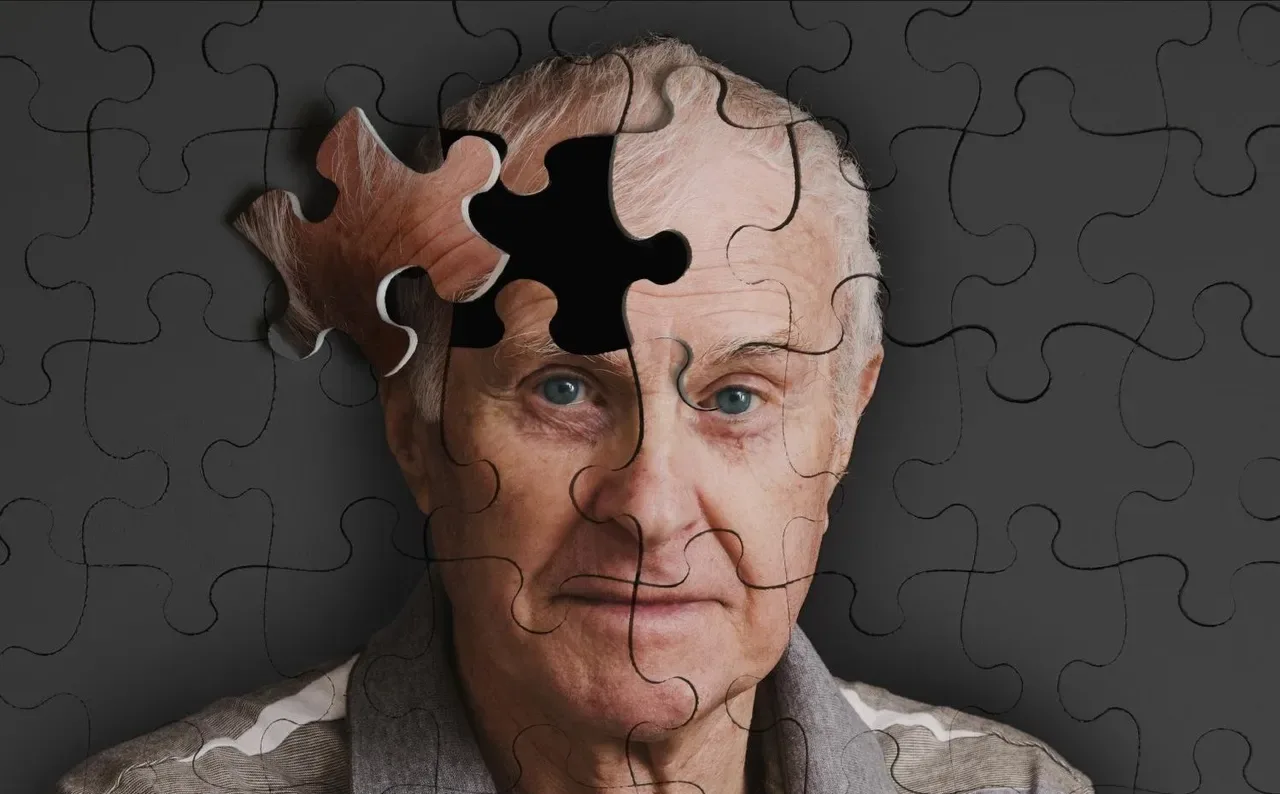 alzheimer