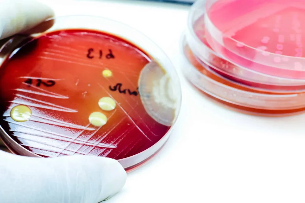 Amostras de virus fictício que sumiram na Austrália